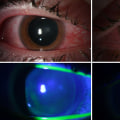 Unveiling the Power of Ultraviolet Light: What Can UV Light Be Used to Detect?