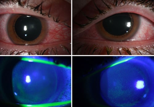 Unveiling the Power of Ultraviolet Light: What Can UV Light Be Used to Detect?